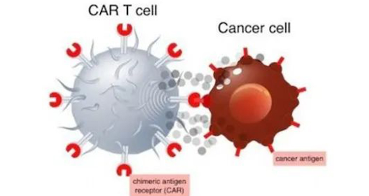 非病毒CAR-T細(xì)胞療法：癌癥治療的&ldquo;無(wú)病毒&rdquo;革命？